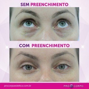 hpv sintomas tratamentos e causas