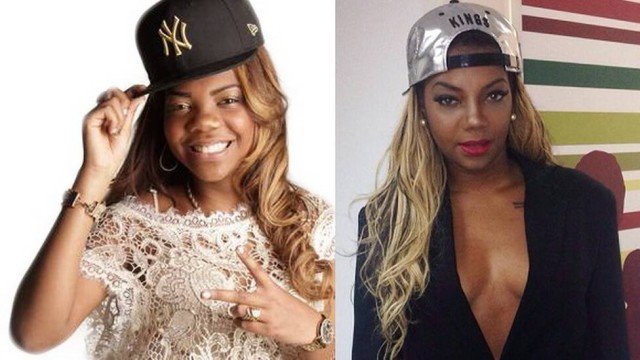 Ludmilla antes e depois das cirurgias no nariz e nas bochechas