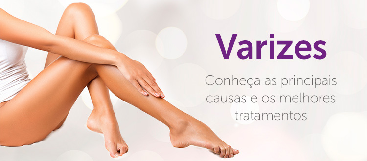 Varizes