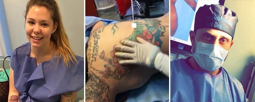 Cirurgião mostra pelo Snapchat como deixar mulher com bumbum de Nicki Minaj