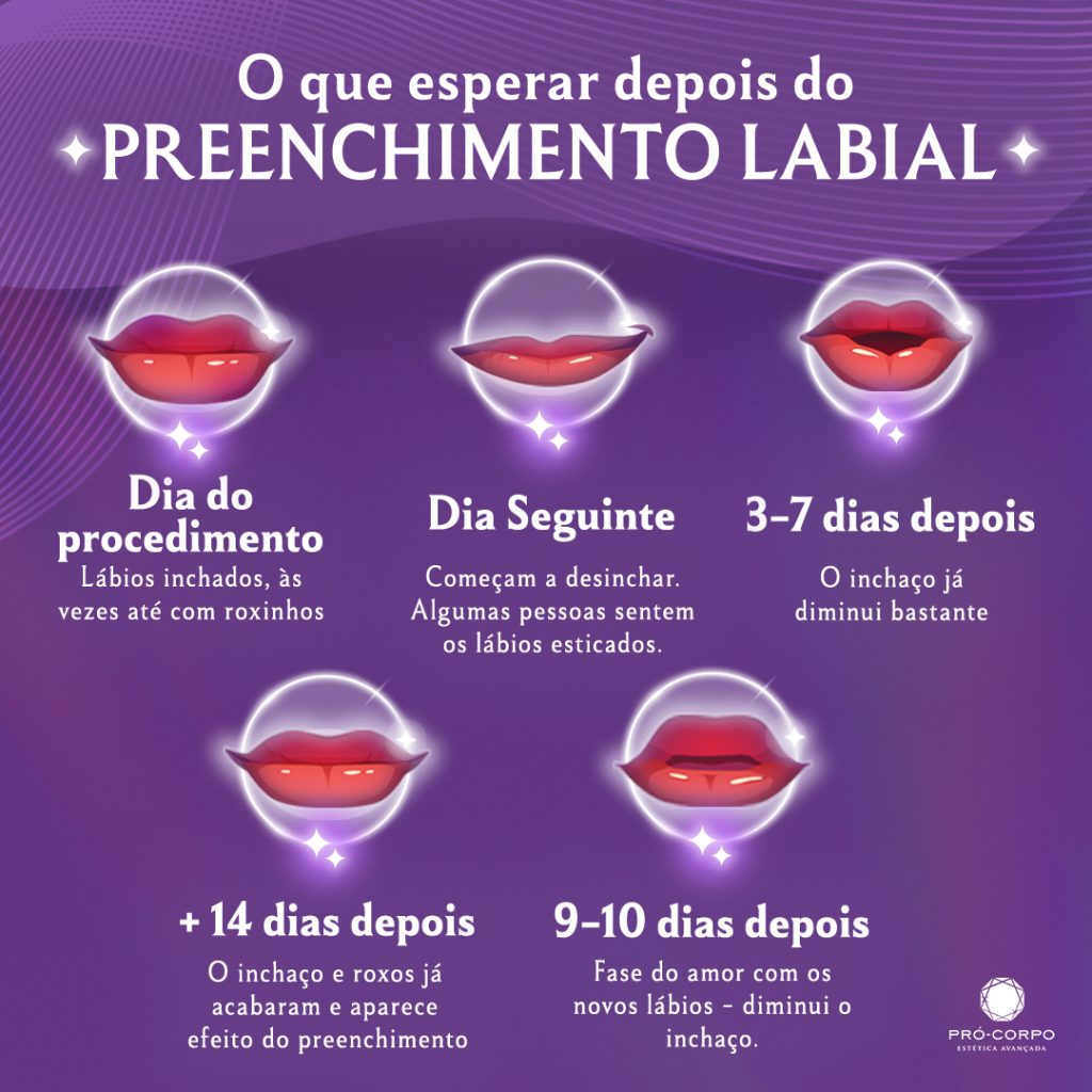 preenchimento labial