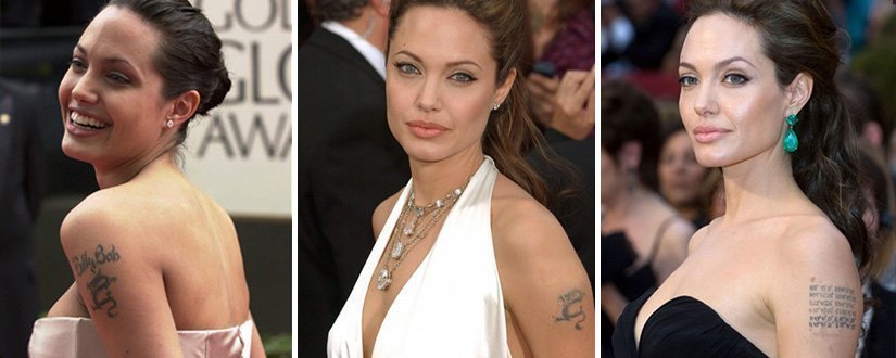 7 famosos que apagaram tatuagens com laser