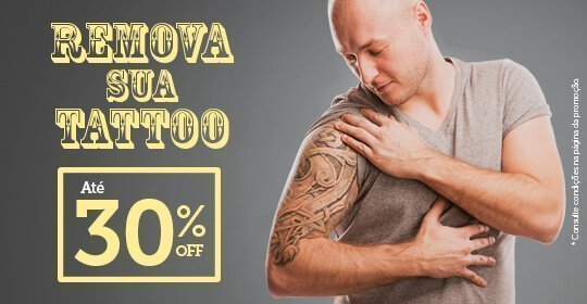 Remova sua Tattoo com 30% OFF