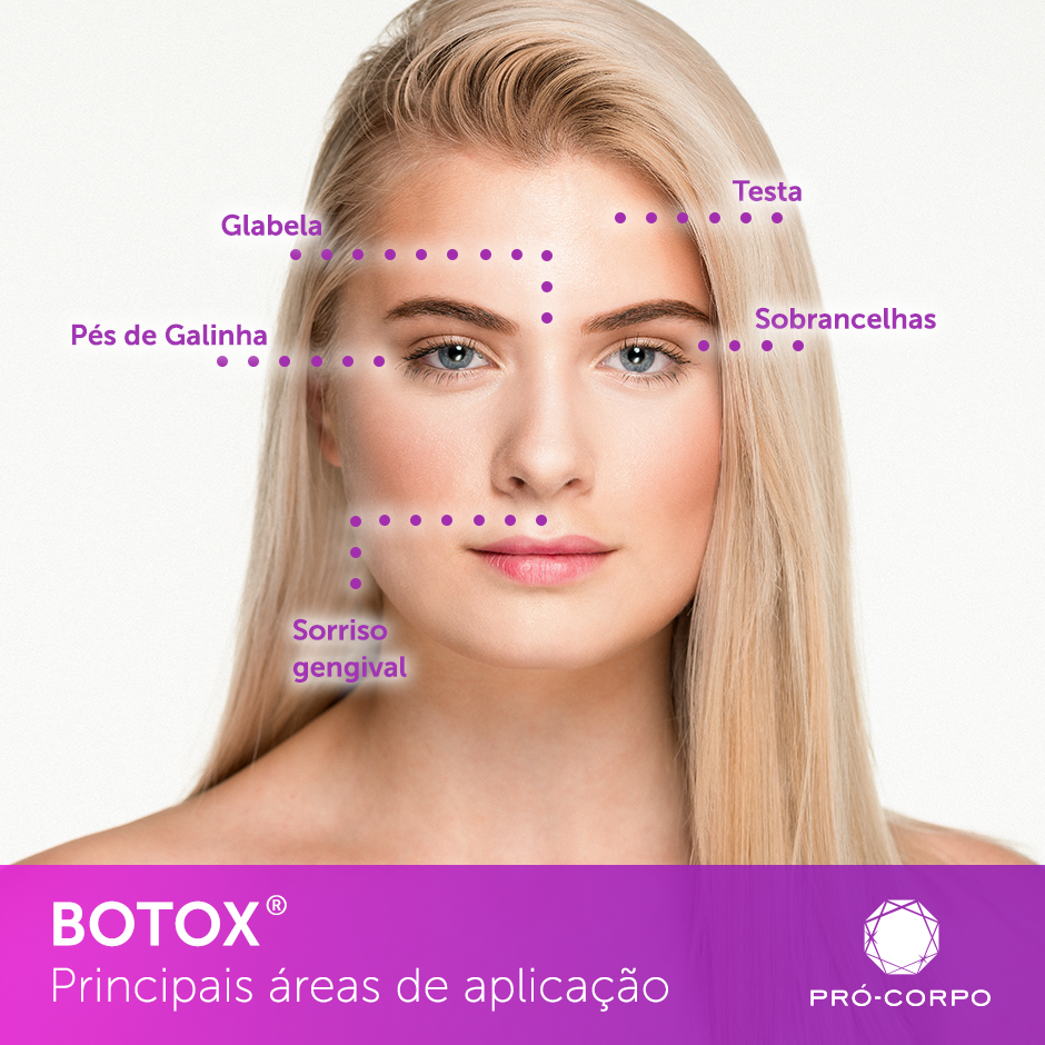 principais áreas de aplicação do botox