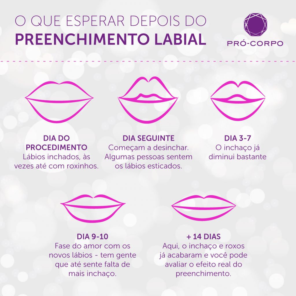 O que esperar do Preenchimento Labial