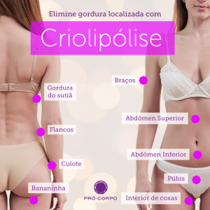 pontos das áreas da criolipólise para mulheres elimine a gordura localizada com esse procedimento