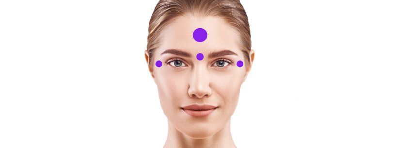 Botox - Principais áreas de aplicação