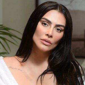 Cleo Pires Melasma