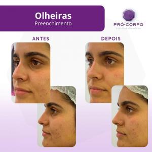 estetica-preventiva
