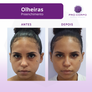 estetica-preventiva