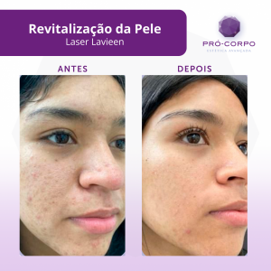estetica-preventiva