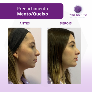 preenchimento-mento