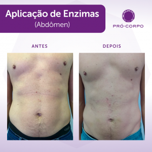 Aplicação de Enzimas Antes e Depois