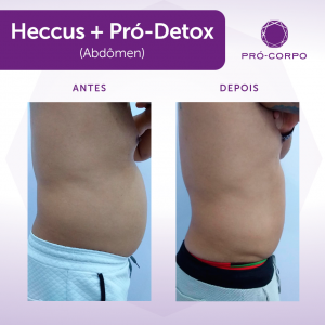 heccus+prodetox-campinas