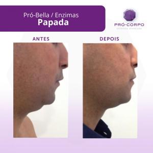 papada