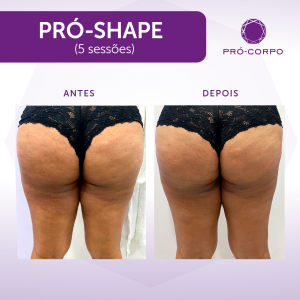 Pró-Shape Fotos de Antes e Depois